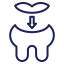 Tooth Filling